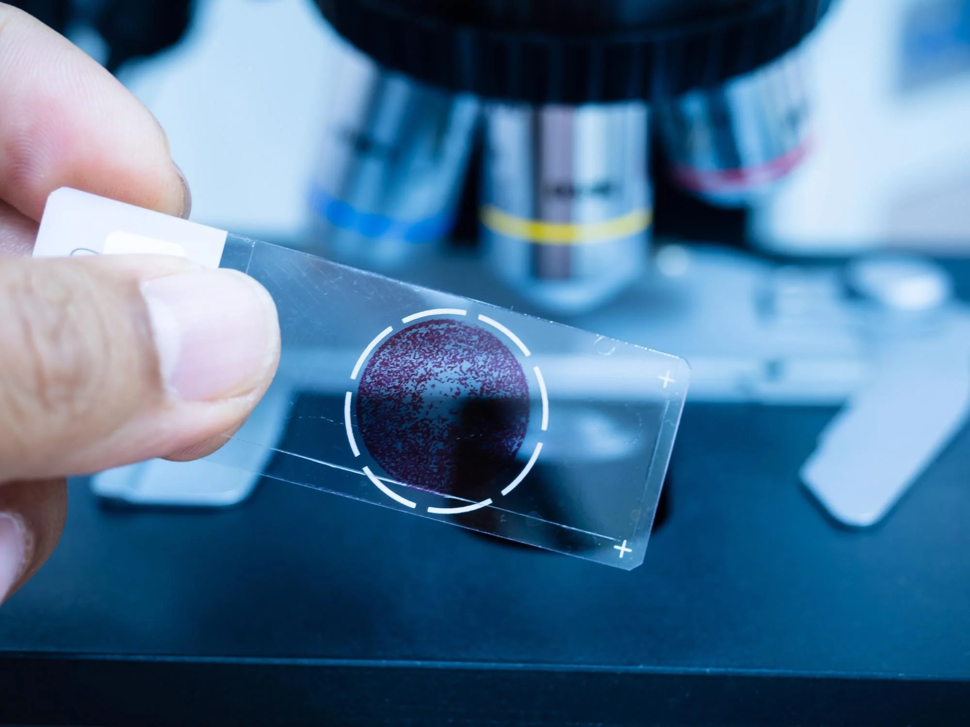 ImageForArticle_2145_16375579068259097